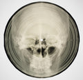 Bone Music: Soviet X-Ray Audio