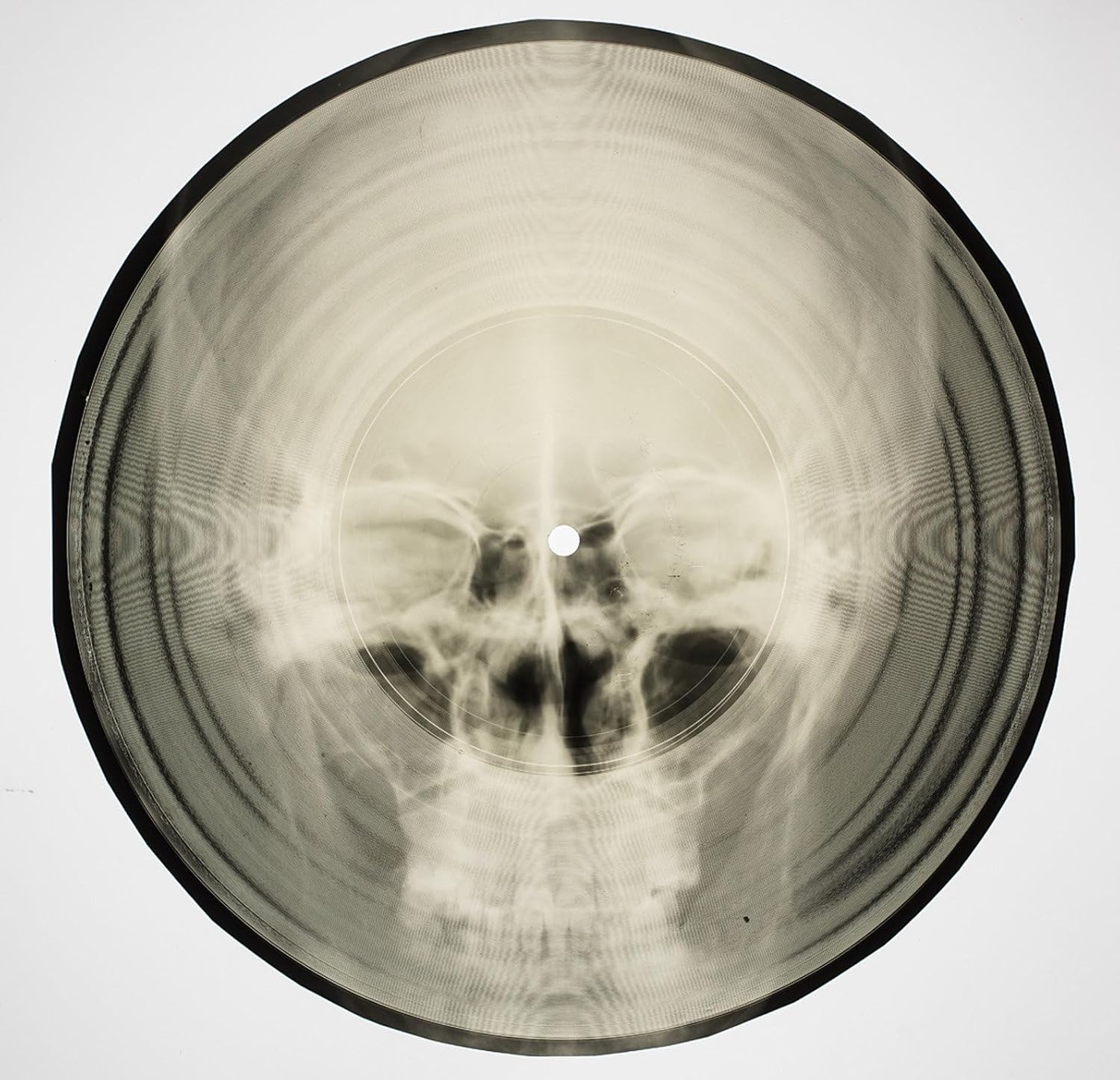 Bone Music: Soviet X-Ray Audio